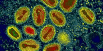 Maranhão tem dois casos confirmados do vírus monkeypox