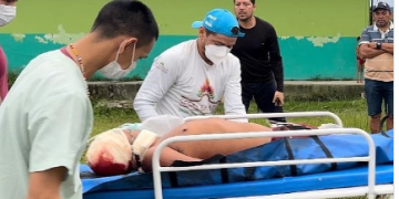 Garimpeiros matam indígena ianomâmi e ferem outros dois em Roraima