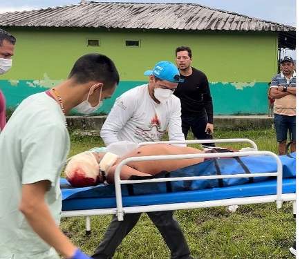 Garimpeiros matam indígena ianomâmi e ferem outros dois em Roraima
